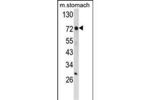 Western blot analysis of ZFP36 Antibody (Center) (ABIN652459 and ABIN2842311) in mouse stomach tissue lysates (35 μg/lane). (ZFP36 antibody  (AA 119-148))