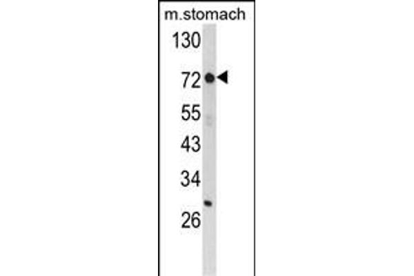 ZFP36 antibody  (AA 119-148)