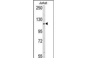 Western blot analysis of anti-USP11 Pab in Jurkat cell line lysates (35ug/lane). (USP11 antibody  (N-Term))