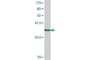 Western Blot detection against Immunogen (37. (PTH1R antibody  (AA 27-134))