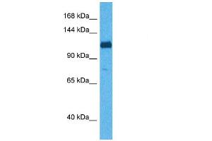 Host:  Rabbit  Target Name:  ABI3BP  Sample Tissue:  Human 293T Whole Cell  Antibody Dilution:  1ug/ml (ABI3BP antibody  (C-Term))