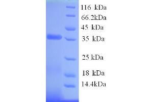 SDS-PAGE (SDS) image for Activation-Induced Cytidine Deaminase (AICDA) (AA 26-312) protein (His tag) (ABIN5713956)