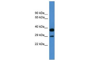 WB Suggested Anti-OTUB2 Antibody Titration: 0. (OTUB2 antibody  (Middle Region))