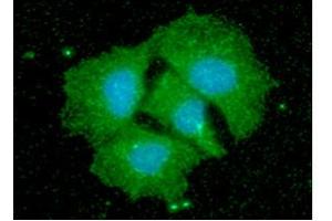 ICC/IF analysis of CPOX in Hep3B cells line, stained with DAPI (Blue) for nucleus staining and monoclonal anti-human CPOX antibody (1:100) with goat anti-mouse IgG-Alexa fluor 488 conjugate (Green). (CPOX antibody)