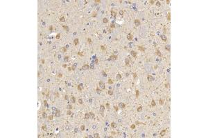 Immunohistochemistry of paraffin embedded rat brain using MAP9 (ABIN7074622) at dilution of 1:750 (300x lens) (MAP9 antibody)