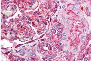 Human Kidney (formalin-fixed, paraffin-embedded) stained with ACTB antibody ABIN218328 at 1:100 followed by biotinylated goat anti-rabbit IgG secondary antibody ABIN481713, alkaline phosphatase-streptavidin and chromogen. (beta Actin antibody  (N-Term))