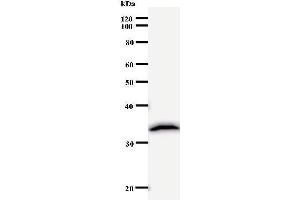 Western Blotting (WB) image for anti-Polymerase (DNA Directed), delta 2, Accessory Subunit (POLD2) (Regulatory Subunit 50) antibody (ABIN931066)