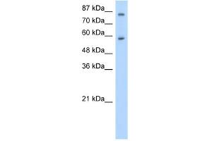 WB Suggested Anti-ZNF777 Antibody Titration:  0. (ZNF777 antibody  (C-Term))