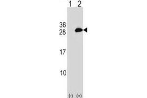 Western Blotting (WB) image for anti-Ubiquitin-Conjugating Enzyme E2T (Ube2t) antibody (ABIN2999419) (Ube2t antibody)