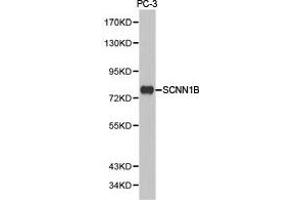 Western Blotting (WB) image for anti-Sodium Channel, Nonvoltage-Gated 1, beta (SCNN1B) antibody (ABIN1874704) (SCNN1B antibody)