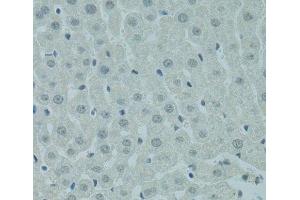 Immunohistochemistry of paraffin-embedded Rat liver using PRDM2 Polyclonal Antibody at dilution of 1:100 (40x lens). (PRDM2 antibody)