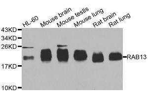 Western blot analysis of extracts of various cell lines, using RAB31 antibody.