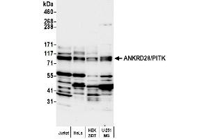 Western Blotting (WB) image for anti-Ankyrin Repeat Domain 28 (ANKRD28) (AA 975-1025) antibody (ABIN7454705)