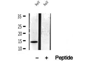 Western blot analysis of extracts of HepG2 cells, using CISD1 antibody. (CISD1 antibody  (Internal Region))