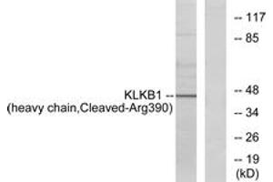 Western blot analysis of extracts from HeLa cells, using KLKB1 (heavy chain,Cleaved-Arg390) Antibody. (KLKB1 antibody  (Cleaved-Arg390))