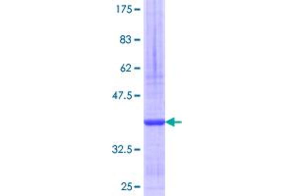 SNTB2 Protein (AA 116-210) (GST tag)