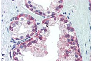 Human Prostate (formalin-fixed, paraffin-embedded) stained with NRF1 antibody ABIN462197 followed by biotinylated goat anti-rabbit IgG secondary antibody ABIN481713, alkaline phosphatase-streptavidin and chromogen. (NRF1 antibody  (AA 360-409))