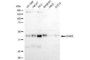 Western blotting analysis using INHBA antibody (ABIN7799030).
