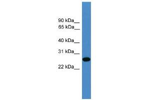 WB Suggested Anti-TIMP2 Antibody Titration: 0.