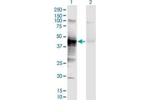 Western Blot analysis of HLA-A expression in transfected 293T cell line by HLA-A monoclonal antibody (M01), clone 2D6. (HLA-A antibody  (AA 24-365))