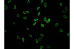 Immunofluorescent analysis of Hela cells (sodium butyrate, 30 mM, 4h) using ABIN7139148 at dilution of 1:100 and Alexa Fluor 488-congugated AffiniPure Goat Anti-Rabbit IgG(H+L) (H2AFZ antibody  (acLys11))