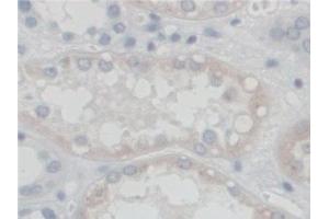 Detection of SGSH in Human Kidney Tissue using Polyclonal Antibody to N-Sulfoglucosamine Sulfohydrolase (SGSH) (SGSH antibody  (AA 21-389))