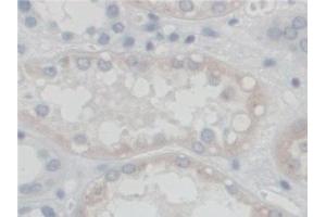 Detection of SGSH in Human Kidney Tissue using Polyclonal Antibody to N-Sulfoglucosamine Sulfohydrolase (SGSH) (SGSH antibody  (AA 21-389))