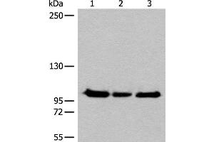 Western blot analysis of Hela K562 and HEPG2 cell lysates using XPO1 Polyclonal Antibody at dilution of 1:200 (XPO1 antibody)