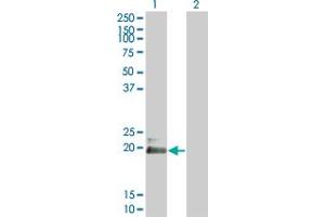 Western Blot analysis of HAND2 expression in transfected 293T cell line by HAND2 monoclonal antibody (M03), clone 3E3. (HAND2 antibody  (AA 135-216))