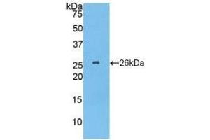 Detection of Recombinant TPPP, Human using Polyclonal Antibody to Tubulin Polymerization Promoting Protein (TPPP) (Tppp antibody  (AA 8-210))