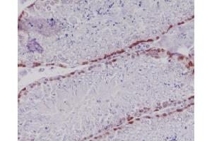 Immunohistochemical analysis of paraffin-embedded mouse testis, using Caspase-2 Antibody. (Recombinant Caspase 2 antibody)
