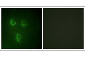 Immunofluorescence analysis of HuvEc cells, using TMEPA Antibody.