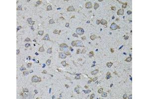 Immunohistochemistry of paraffin-embedded Mouse brain using IL1A Polyclonal Antibody at dilution of 1:100 (40x lens). (IL1A antibody)