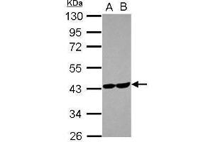 WB Image Sample (30 ug of whole cell lysate) A: U87-MG B: MCF-7 10% SDS PAGE antibody diluted at 1:1000 (ALDOC antibody)