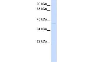 WB Suggested Anti-GDAP1L1 Antibody Titration:  0. (GDAP1L1 antibody  (N-Term))