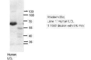 Western Blotting (WB) image for anti-Autoimmune Regulator (AIRE) (N-Term) antibody (ABIN2779777)