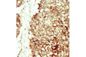 Immunohistochemistry (Paraffin-embedded Sections) (IHC (p)) image for anti-Fibroblast Growth Factor Receptor 2 (FGFR2) (C-Term) antibody (ABIN359855)