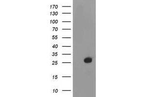 Western Blotting (WB) image for anti-Deoxythymidylate Kinase (Thymidylate Kinase) (DTYMK) antibody (ABIN1497922) (DTYMK antibody)