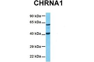 Host:  Rabbit  Target Name:  CHRNA1  Sample Tissue:  Human Fetal Lung  Antibody Dilution:  1. (CHRNA1 antibody  (C-Term))