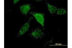Immunofluorescence of purified MaxPab antibody to ACOX1 on HeLa cell. (ACOX1 antibody  (AA 1-660))