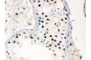 Anti- MNAT1 Picoband antibody, IHC(P) IHC(P): Human Testis Tissue (MNAT1 antibody  (AA 92-278))