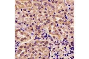Immunohistochemical analysis of GIP staining in rat kidney formalin fixed paraffin embedded tissue section. (GIP antibody)