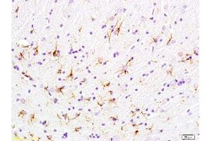Formalin-fixed and paraffin embedded rat brain labeled with Anti-phospho-GFAP Polyclonal Antibody, Unconjugated  at 1:200 followed by conjugation to the secondary antibody and DAB staining (GFAP antibody  (pSer8))