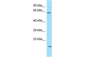 WB Suggested Anti-SOWAHC Antibody Titration: 1. (ANKRD57 antibody  (C-Term))