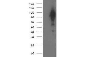 HEK293T cells were transfected with the pCMV6-ENTRY control (Left lane) or pCMV6-ENTRY BCAR1 (Right lane) cDNA for 48 hrs and lysed. (BCAR1 antibody)