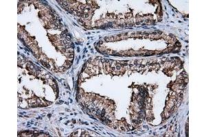 Immunohistochemical staining of paraffin-embedded liver tissue using anti-FAHD2A mouse monoclonal antibody.