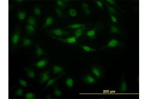 Immunofluorescence of monoclonal antibody to STAT5B on HeLa cell. (STAT5B antibody  (AA 678-787))
