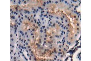 Used in DAB staining on fromalin fixed paraffin- embedded Kidney tissue (C3orf15 antibody  (AA 29-181))