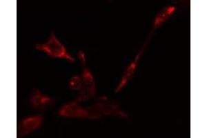 ABIN6275123 staining Hela cells by IF/ICC. (EIF5B antibody  (C-Term))