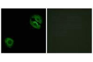 Immunofluorescence analysis of A549 cells, using Collagen XIX α1 antibody. (COL19A1 antibody)